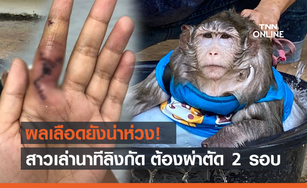 นักข่าวเล่านาทีถูก "เจ้าก็อตซิลล่า" กัด ล่าสุดผลเลือดยังน่าเป็นห่วง!