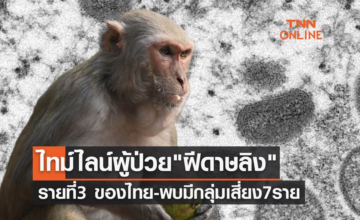 เปิดไทม์ไลน์ผู้ป่วย ฝีดาษลิง รายที่ 3 ของไทย พบมีกลุ่มเสี่ยง 7 ราย 