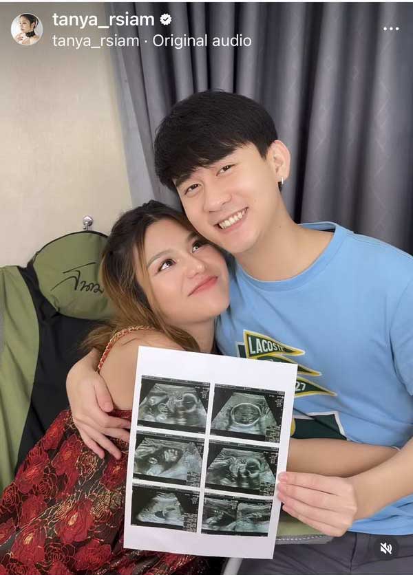 ธัญญ่า อาร์สยาม แอดมิทรพ.กลางดึก ปวดท้อง-ปากมดลูกเปิด เสี่ยงคลอดก่อนกำหนด ธัญญ่า อาร์สยาม แอดมิทรพ.กลางดึก ปวดท้อง-ปากมดลูกเปิด เสี่ยงคลอดก่อนกำหนด
