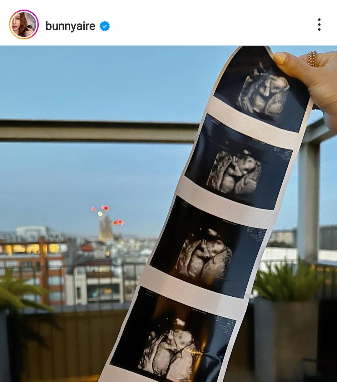 แอร์ ภัณฑิลา ประกาศข่าวดี ท้องลูกคนแรกแล้ว แอร์ ภัณฑิลา ประกาศข่าวดี ท้องลูกคนแรกแล้ว