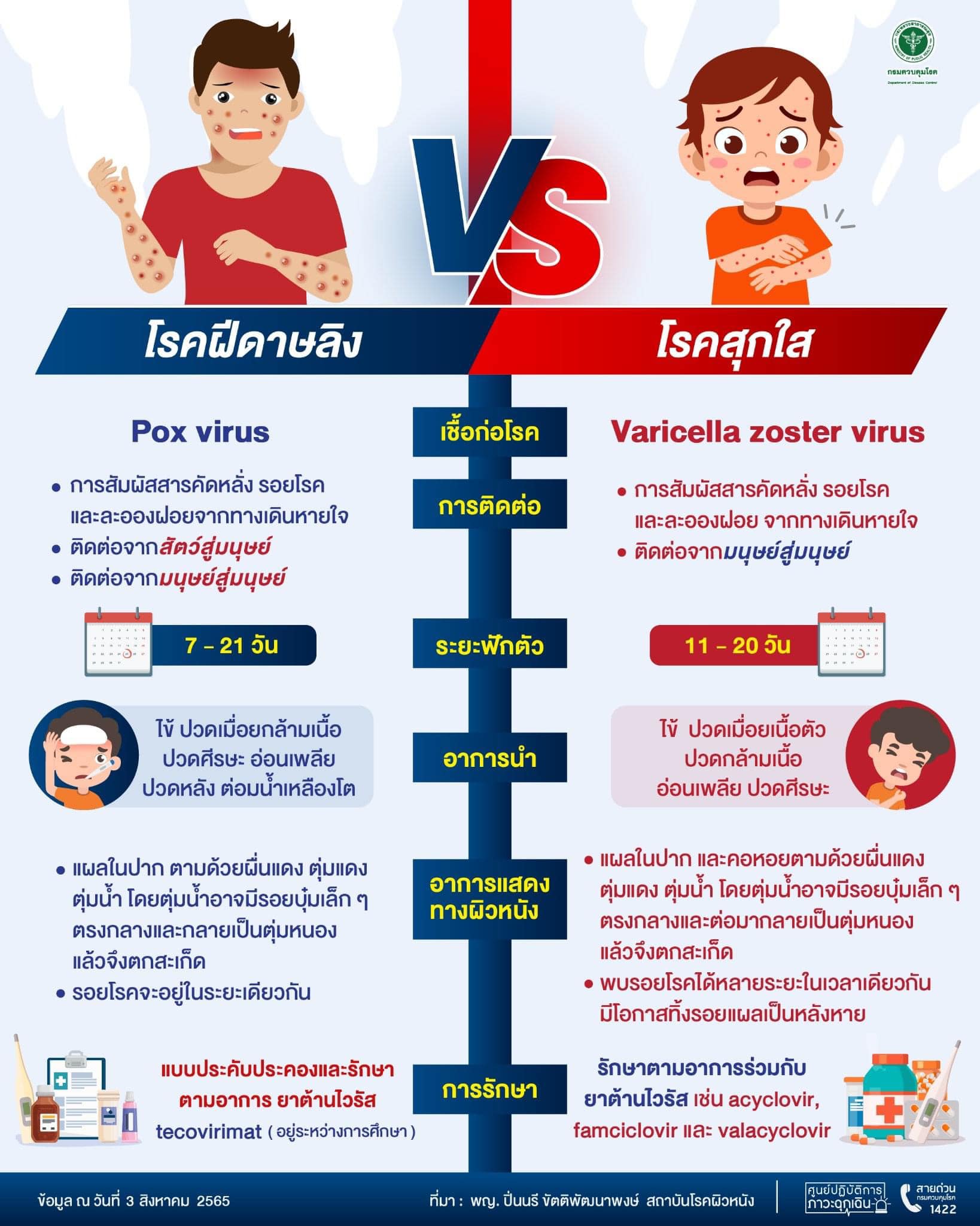ฝีดาษลิง VS โรคสุกใส ต่างกันอย่างไร มีระยะฟักตัวกี่วัน