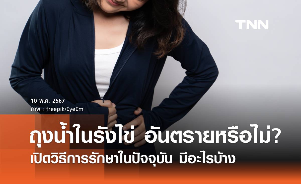 "ถุงน้ำในรังไข่" อันตรายหรือไม่? เปิดวิธีการรักษาในปัจจุบัน มีอะไรบ้าง
