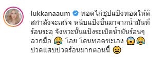 อุ้ม ลักขณา   น้ำมันร้อนๆระเบิดลวกมือ เข้าโรงพยาบาลด่วน!!