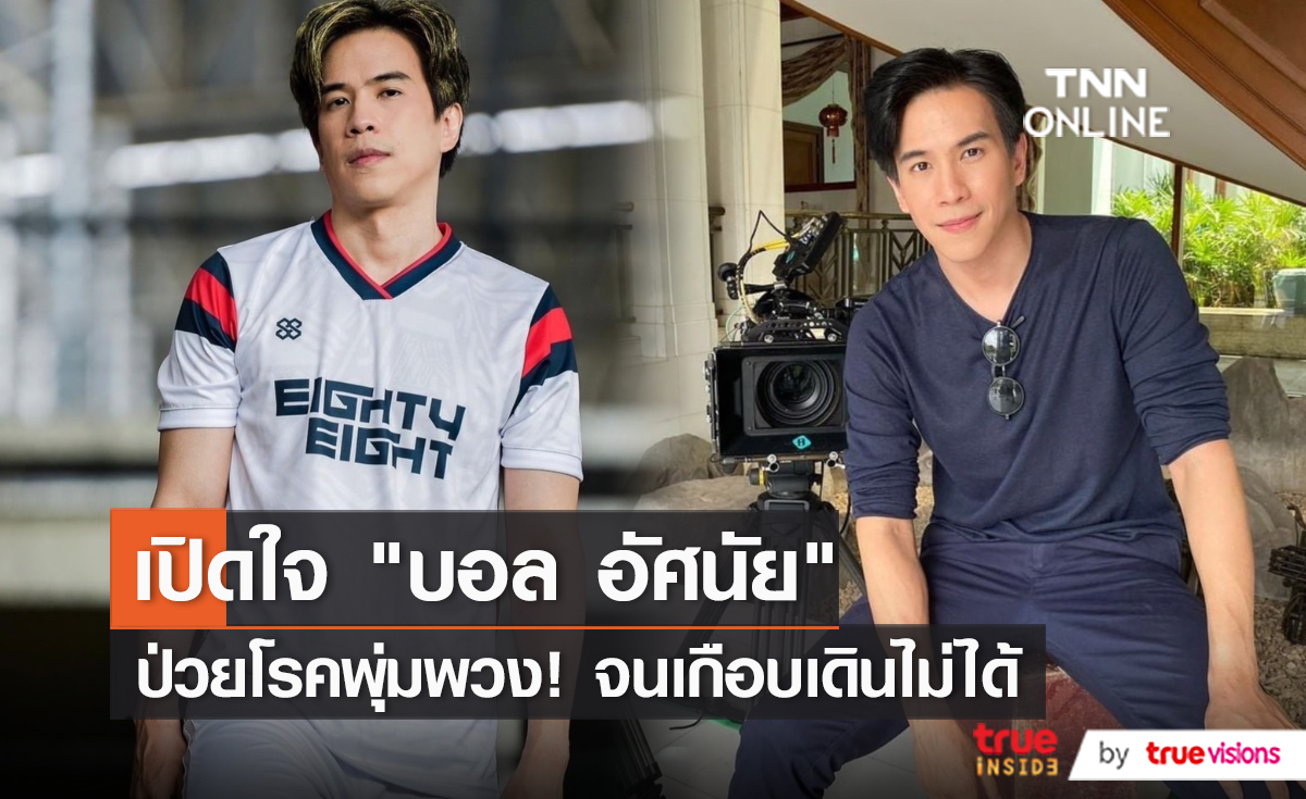 “บอล อัศนัย” เผยเคยป่วยเป็นโรคแพ้ภูมิตัวเอง (SLE) จนเดินไม่ได้ (มีคลิป)        