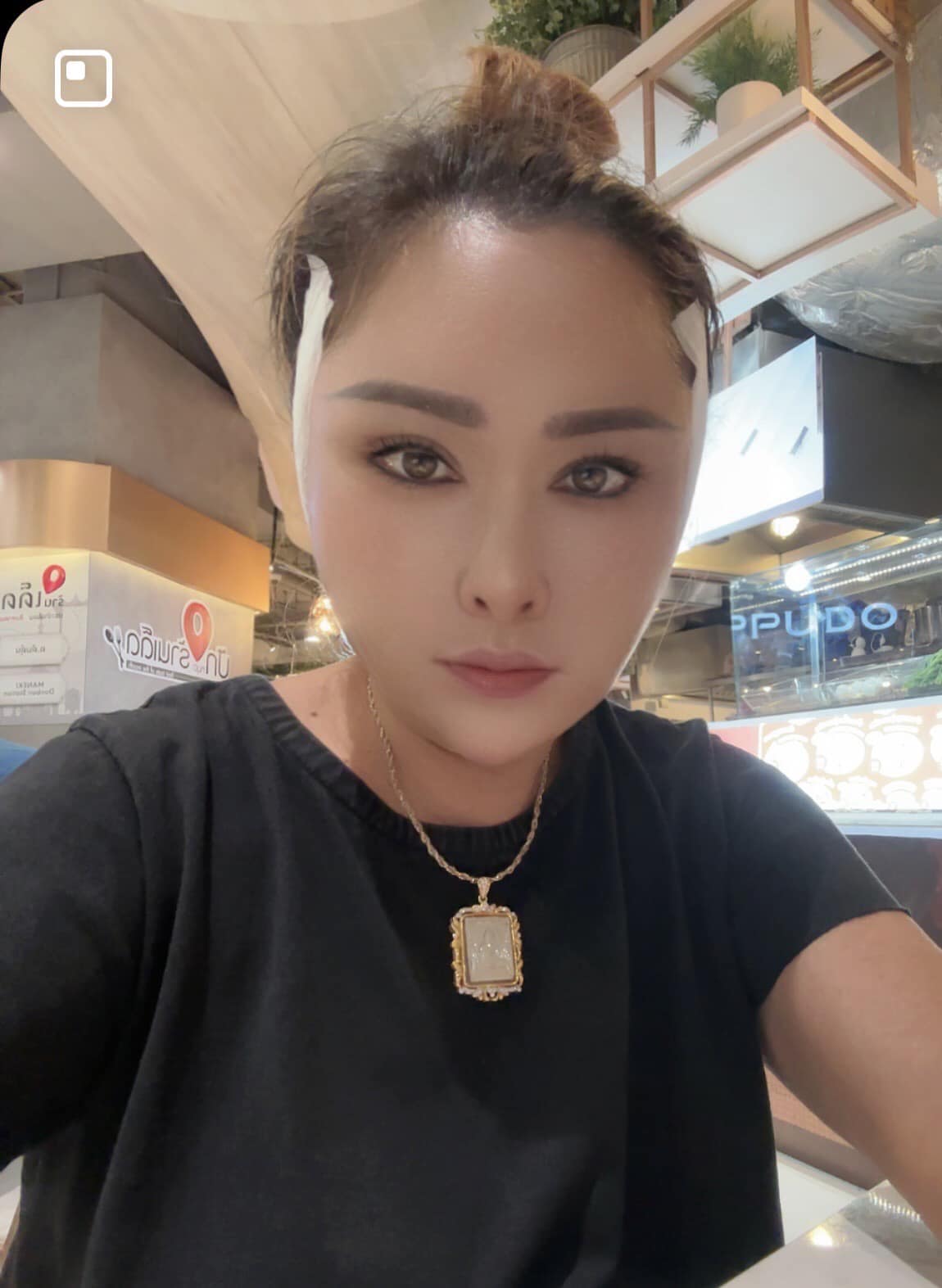 ย้อนวัยไปหลายสิบปี อ้อย กระท้อน ขึ้นเขียงศัลยกรรมดึงหน้า ย้อนวัยไปหลายสิบปี อ้อย กระท้อน ขึ้นเขียงศัลยกรรมดึงหน้า