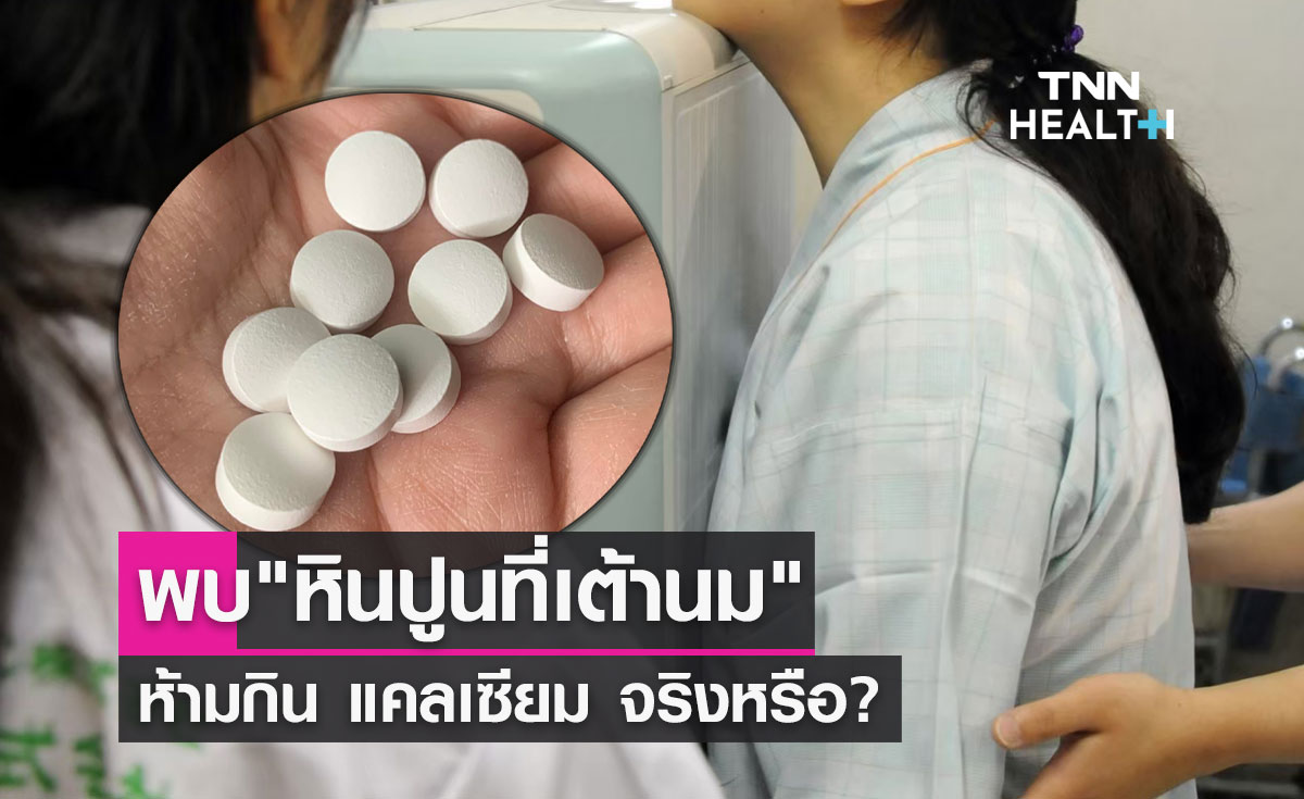 พบ"หินปูนที่เต้านม" ห้ามกินแคลเซียม จริงหรือ หมออดุลย์ มีคำตอบ?