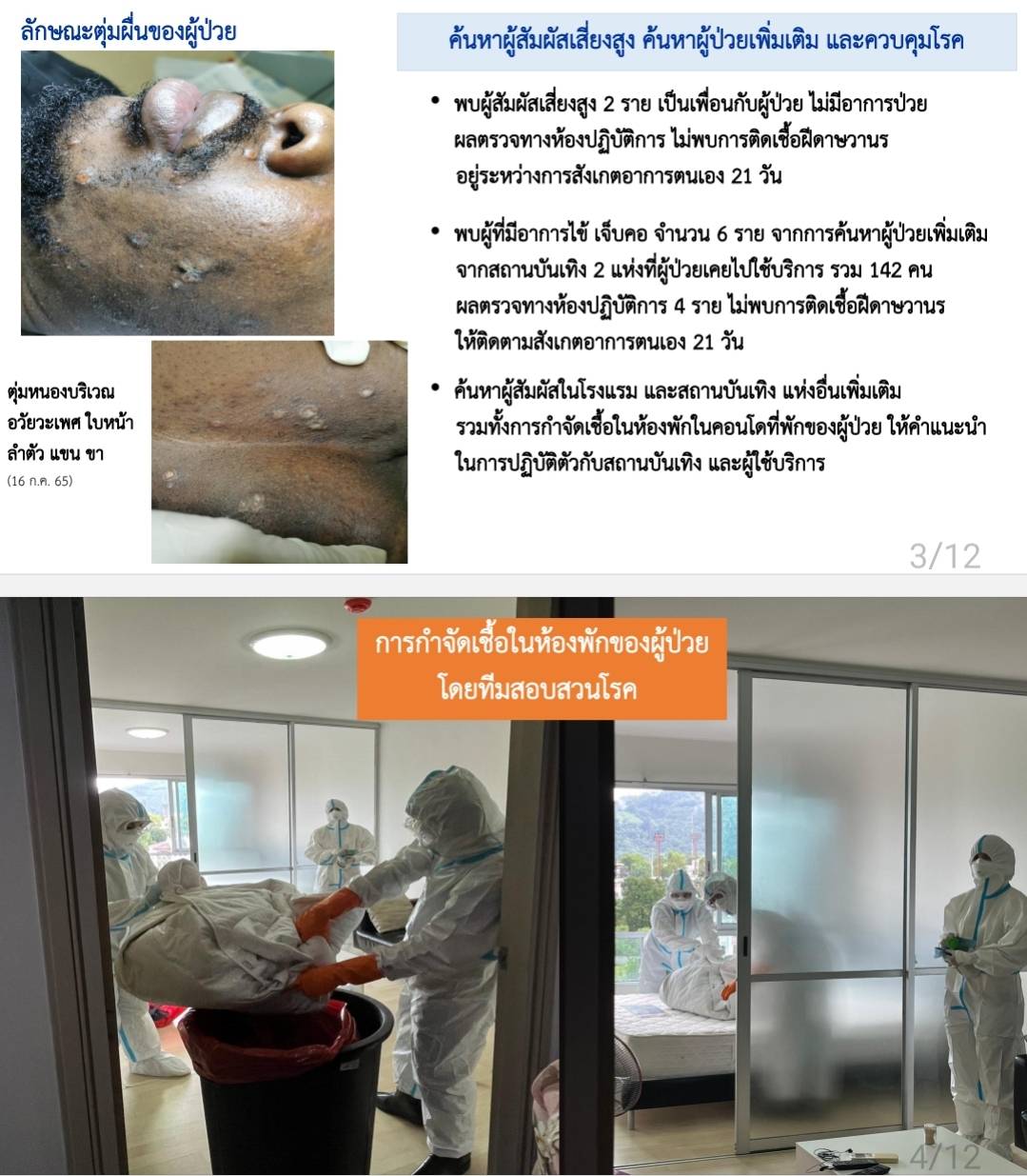 แถลงด่วน! ฝีดาษลิง รายแรกของไทยที่ภูเก็ต ยังไม่พบตัว เชื่อยังไม่ออกนอกประเทศ แถลงด่วน! ฝีดาษลิง รายแรกของไทยที่ภูเก็ต ยังไม่พบตัว เชื่อยังไม่ออกนอกประเทศ
