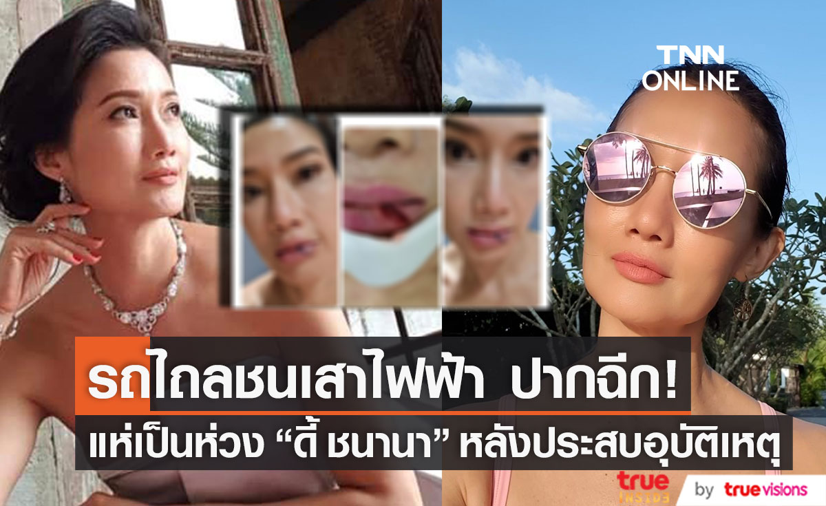 ประสบอุบัติเหตุ "ดี้ ชนานา" รถไถลชนเสาไฟฟ้า ปากฉีก!!