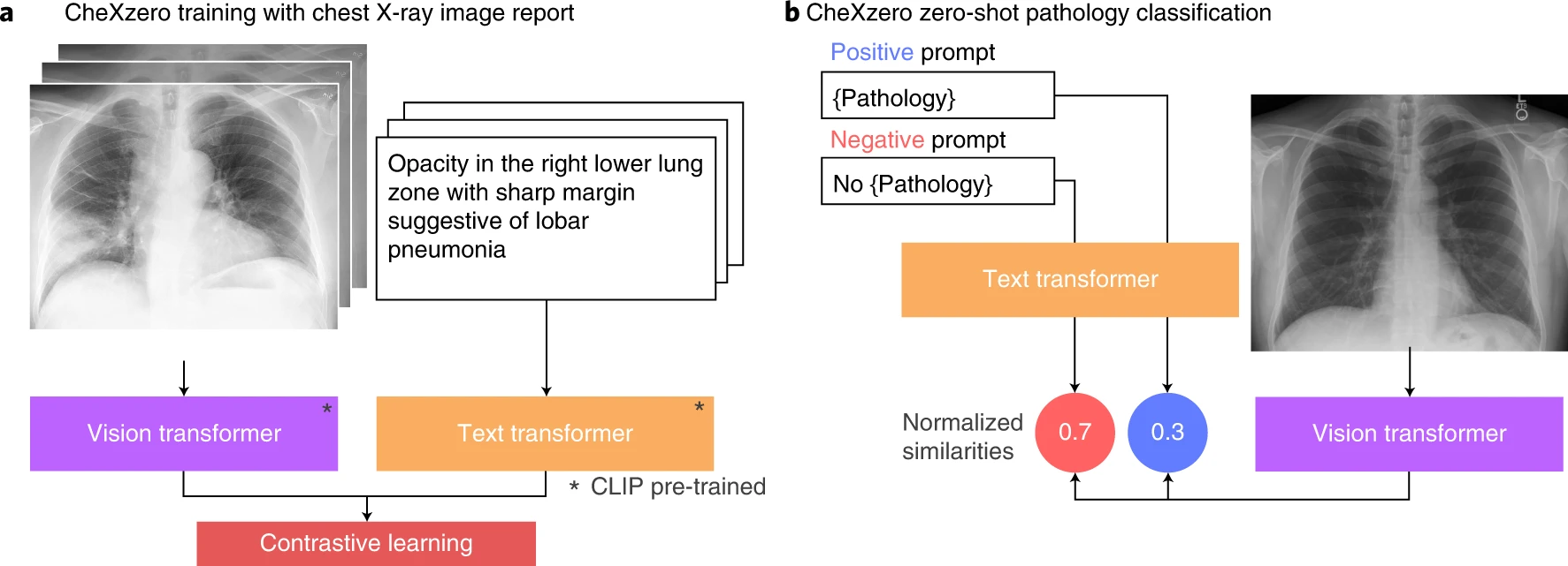 AI ยุคใหม่ เรียนรู้และอ่านฟิล์ม X-Ray ได้เอง ไม่ต้องป้อนข้อมูลทีละโรค