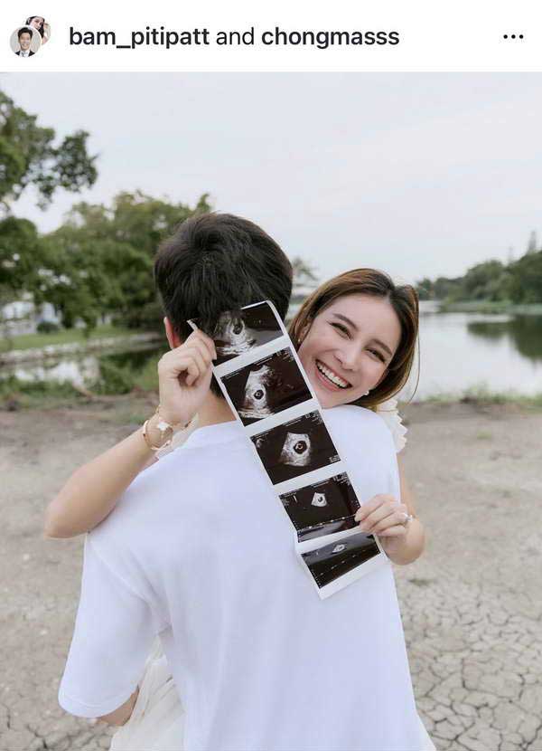 แบม ปีติภัทร เฮ!ได้ของขวัญวันเกิดสุดพิเศษ ภรรยากำลังตั้งท้องลูกคนแรก แบม ปีติภัทร เฮ!ได้ของขวัญวันเกิดสุดพิเศษ ภรรยากำลังตั้งท้องลูกคนแรก
