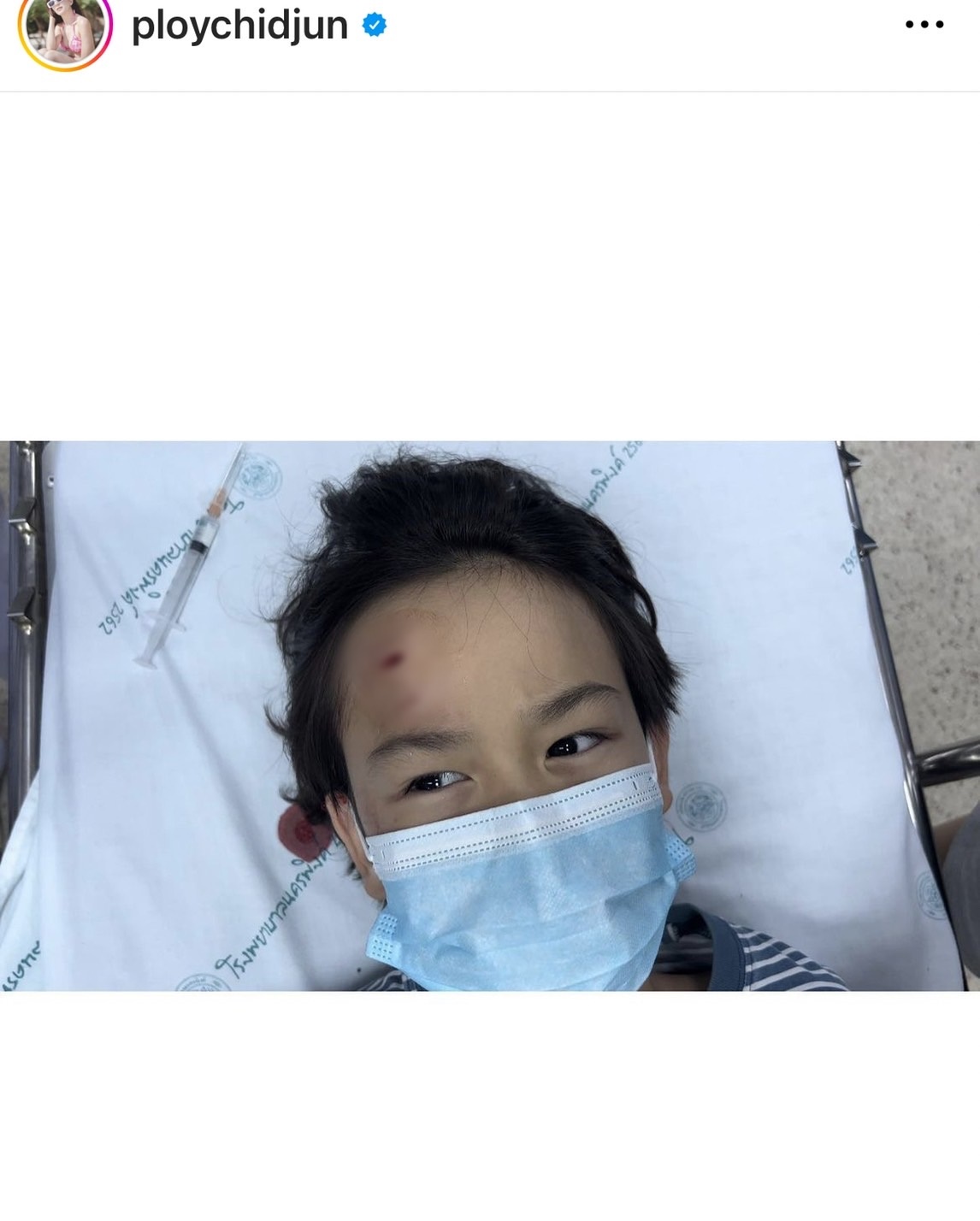 พลอย ชิดจันทร์ สุดห่วงลูกชาย หัวแตก เย็บ2 เข็ม