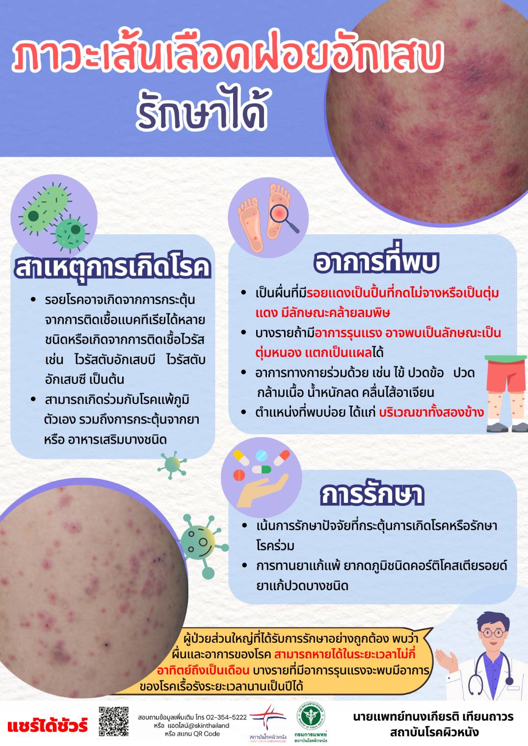 รู้จัก ภาวะเส้นเลือดฝอยอักเสบ ลักษณะรอยโรคเป็นอย่างไร รู้จัก ภาวะเส้นเลือดฝอยอักเสบ ลักษณะรอยโรคเป็นอย่างไร