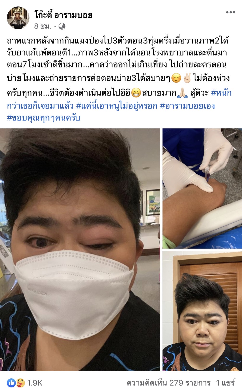 โก๊ะตี๋ แพ้หนัก!! หลังกินแมงป่อง 3 ตัว ต้องแอดมิทรพ. โก๊ะตี๋ แพ้หนัก!! หลังกินแมงป่อง 3 ตัว ต้องแอดมิทรพ.
