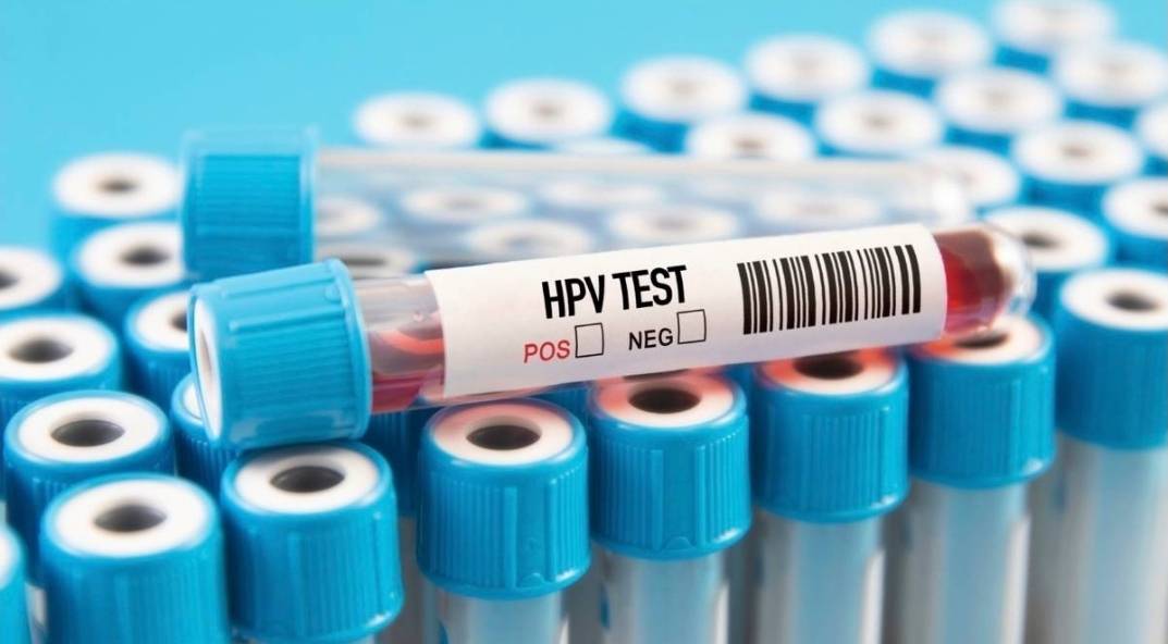 ข่าวนี้จริงไหม... ใช้ห้องน้ำสาธารณะ เสี่ยงติดเชื้อ HPV ? ข่าวนี้จริงไหม... ใช้ห้องน้ำสาธารณะ เสี่ยงติดเชื้อ HPV ?
