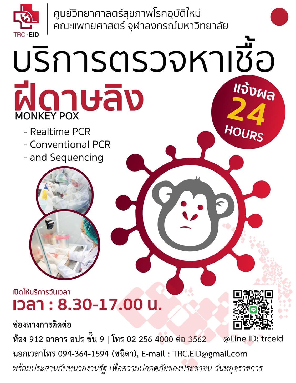 ชี้เป้าตรวจ 'โรคฝีดาษลิง' คณะแพทย์จุฬาฯแจ้งผลใน 24 ชม. 