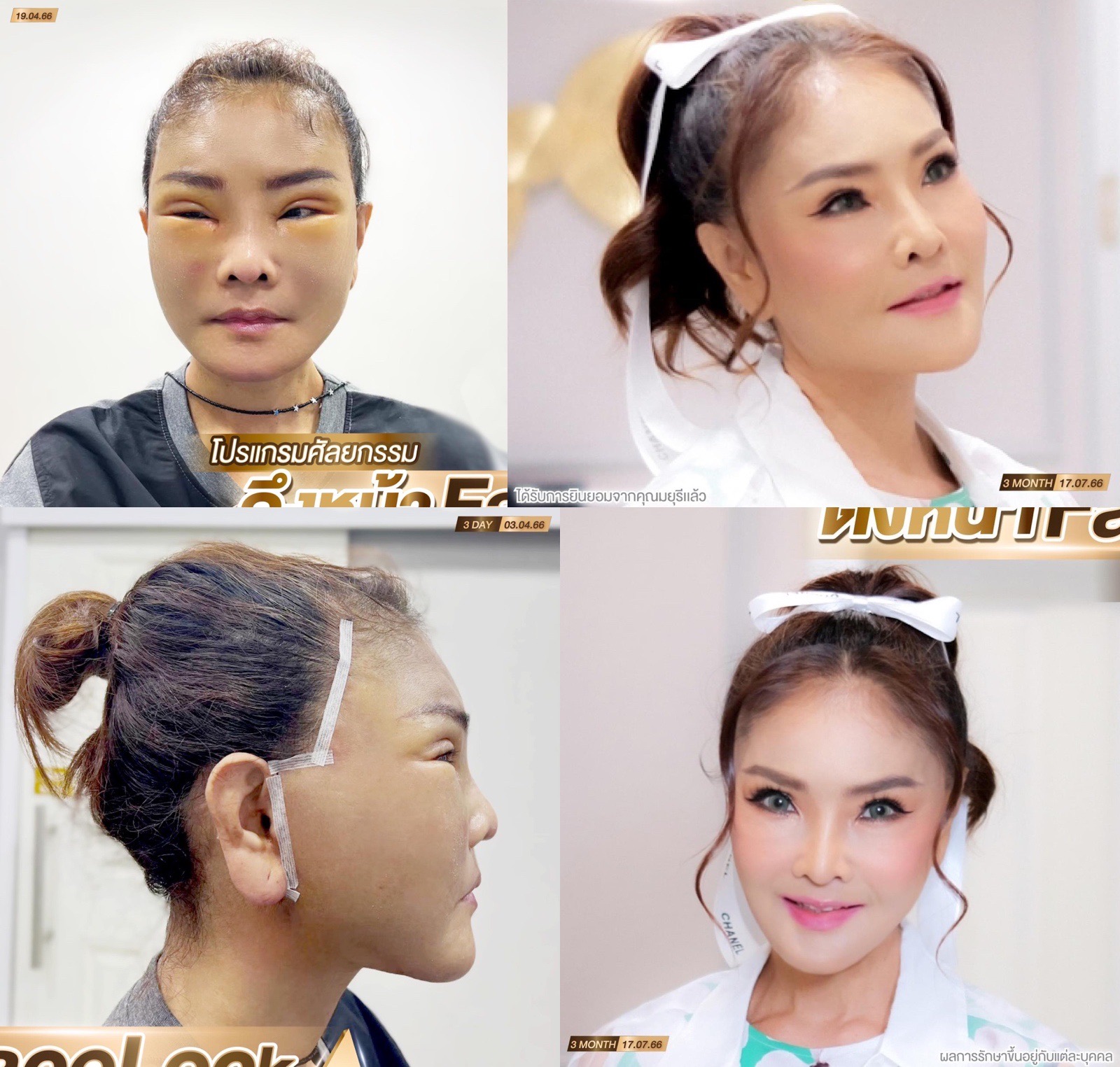 ดาว มุยรี เดือด!! ซัดกลับชาวเน็ตแซะ หน้าเหมือนตุ๊กตายาง ดาว มุยรี เดือด!! ซัดกลับชาวเน็ตแซะ หน้าเหมือนตุ๊กตายาง