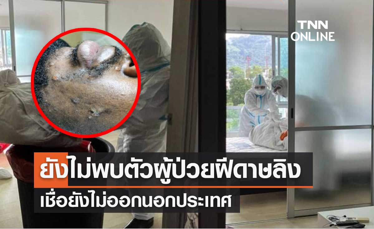 แถลงด่วน! ฝีดาษลิง รายแรกของไทยที่ภูเก็ต ยังไม่พบตัว เชื่อยังไม่ออกนอกประเทศ