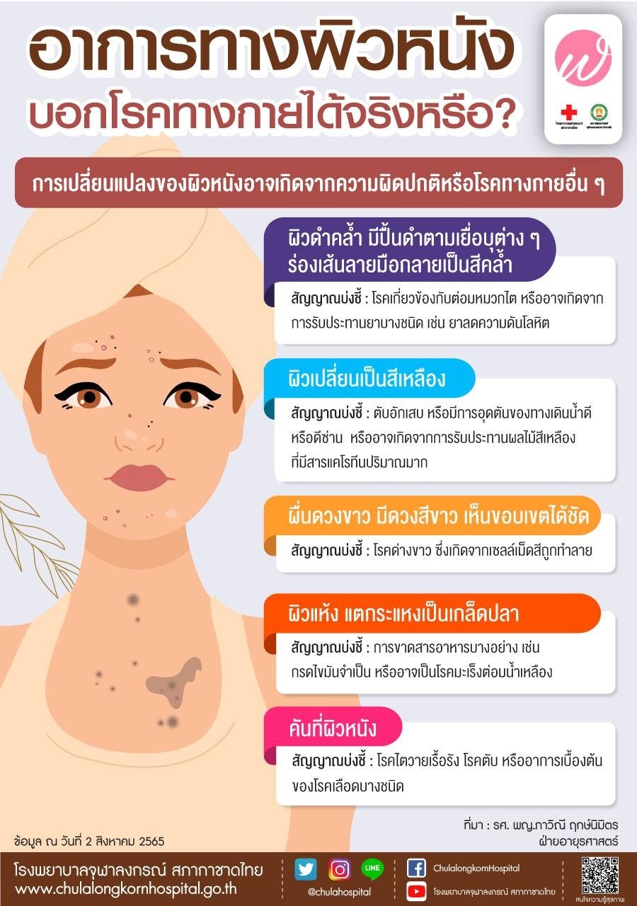อาการทางผิวหนัง บอกโรคทางกายได้จริงหรือ? 