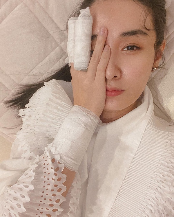  “กระติ๊บ ชวัลกร” หวิดเสียโฉม หลังถูกน้ำมันลวกครั้งที่ 2 (มีคลิป)