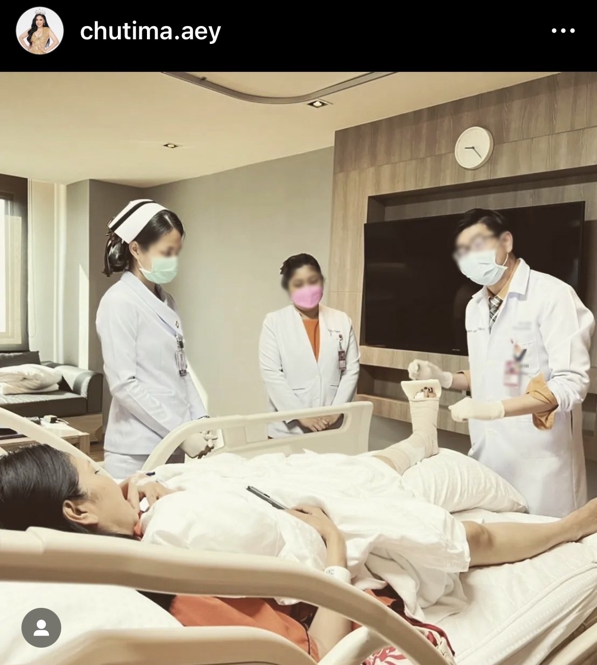 ฟาดเคราะห์!! เอ้ ชุติมา เกิดอุบัติเหตุ กระดูกนิ้วเท้าร้าว ต้องใส่เฝือกอ่อน