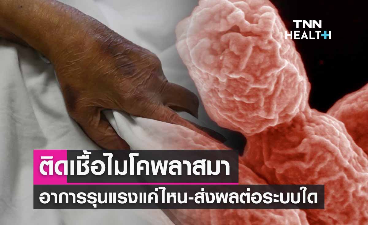 ไมโคพลาสมา (Mycoplasma) หมอตอบให้ติดเชื้อแล้วรุนแรงแค่ไหน