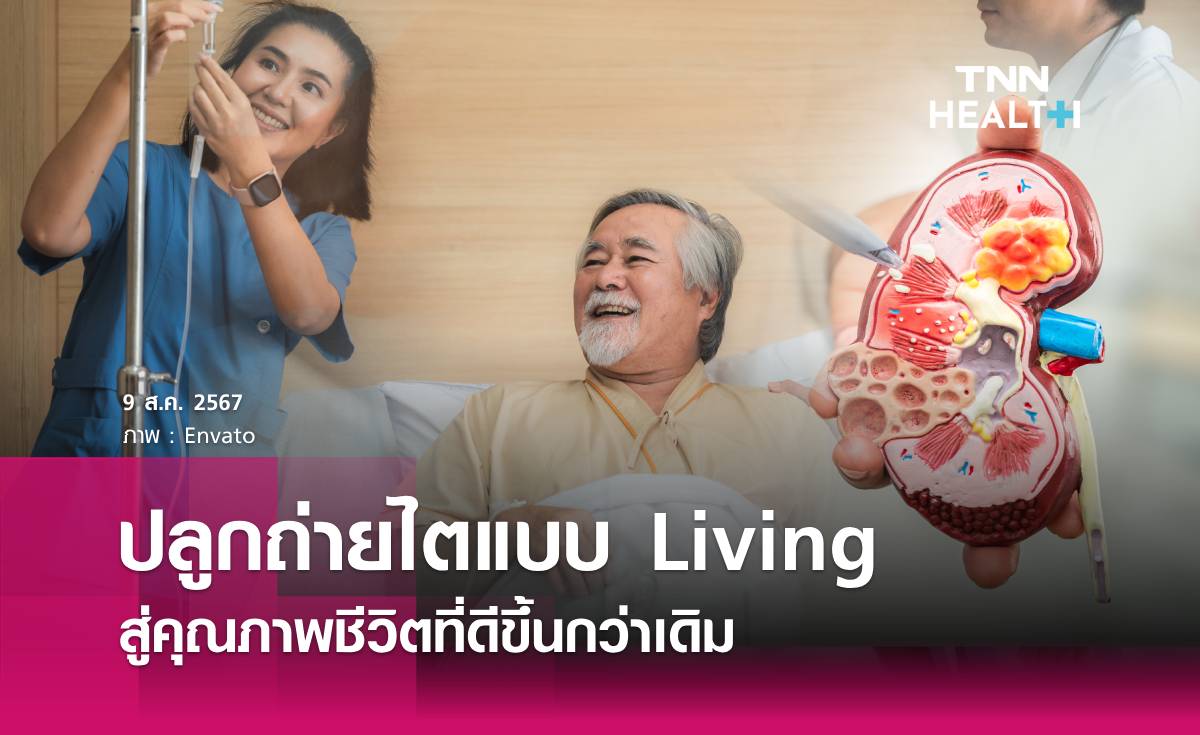 ปลูกถ่ายไตแบบ Living สู่คุณภาพชีวิตที่ดีขึ้นกว่าเดิม