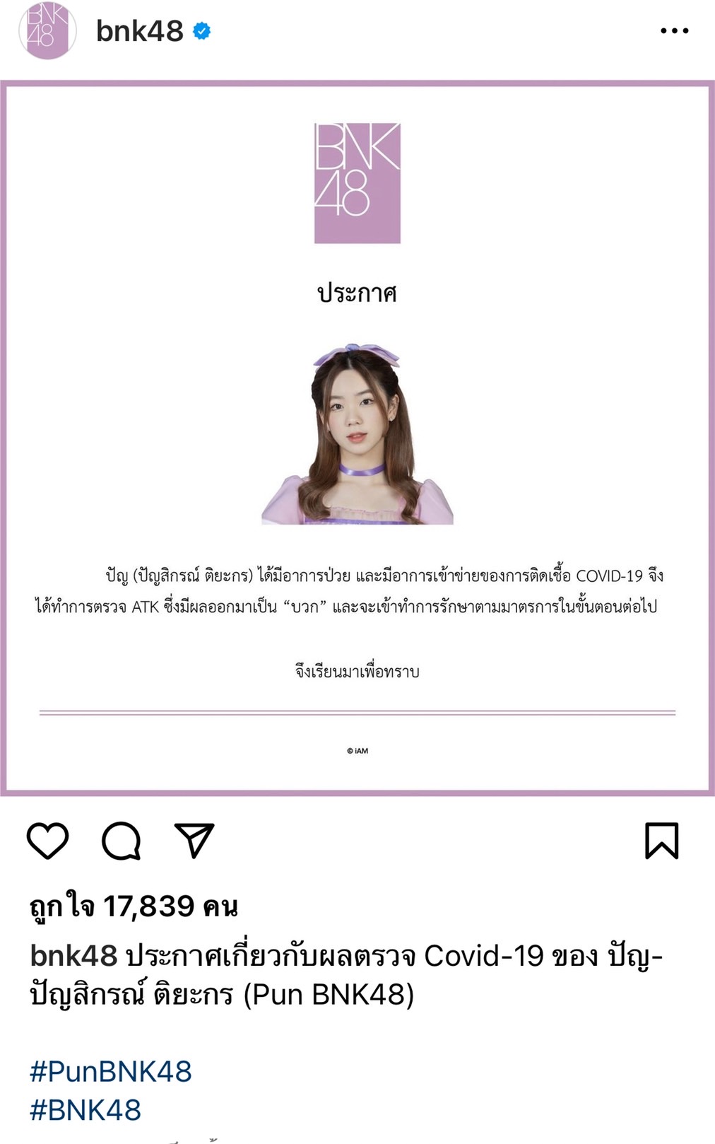 แฟนคลับเป็นห่วง ปัญ- โมบายล์ ติดโควิด-19 