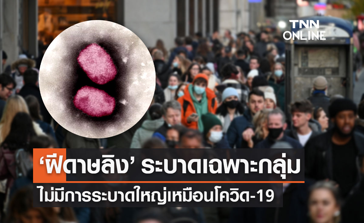 "หมอยง" เผยไทยเสี่ยงเจอ "ฝีดาษลิง" แต่ระบาดเฉพาะกลุ่ม พบผู้ป่วย 98% เป็นเพศชาย