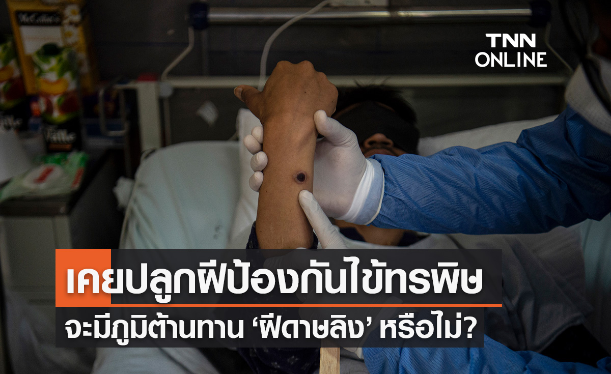 "หมอยง" ไขข้อสงสัยผู้ที่เคยปลูกฝีป้องกันไข้ทรพิษ จะมีภูมิต้านทาน "ฝีดาษลิง" หรือไม่?