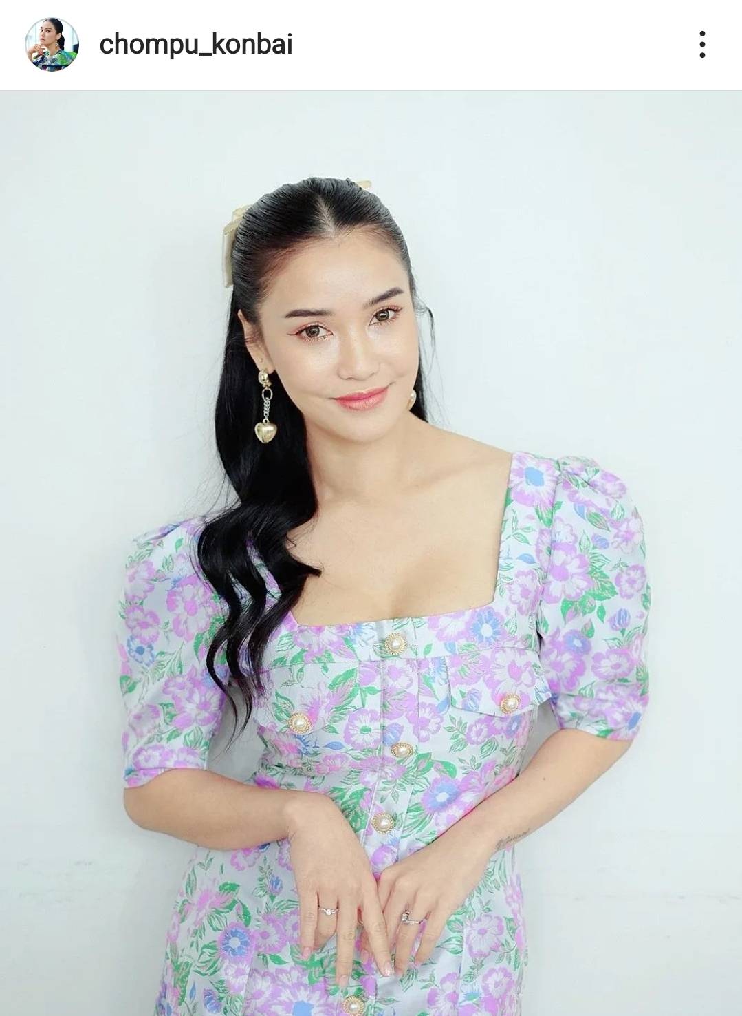 ประสบการณ์ครอบครัว ชมพู่ ธัณย์สิตา เผยภาพลูกชายหลังเกิดอุบัติเหตุขณะวิ่งเล่น 