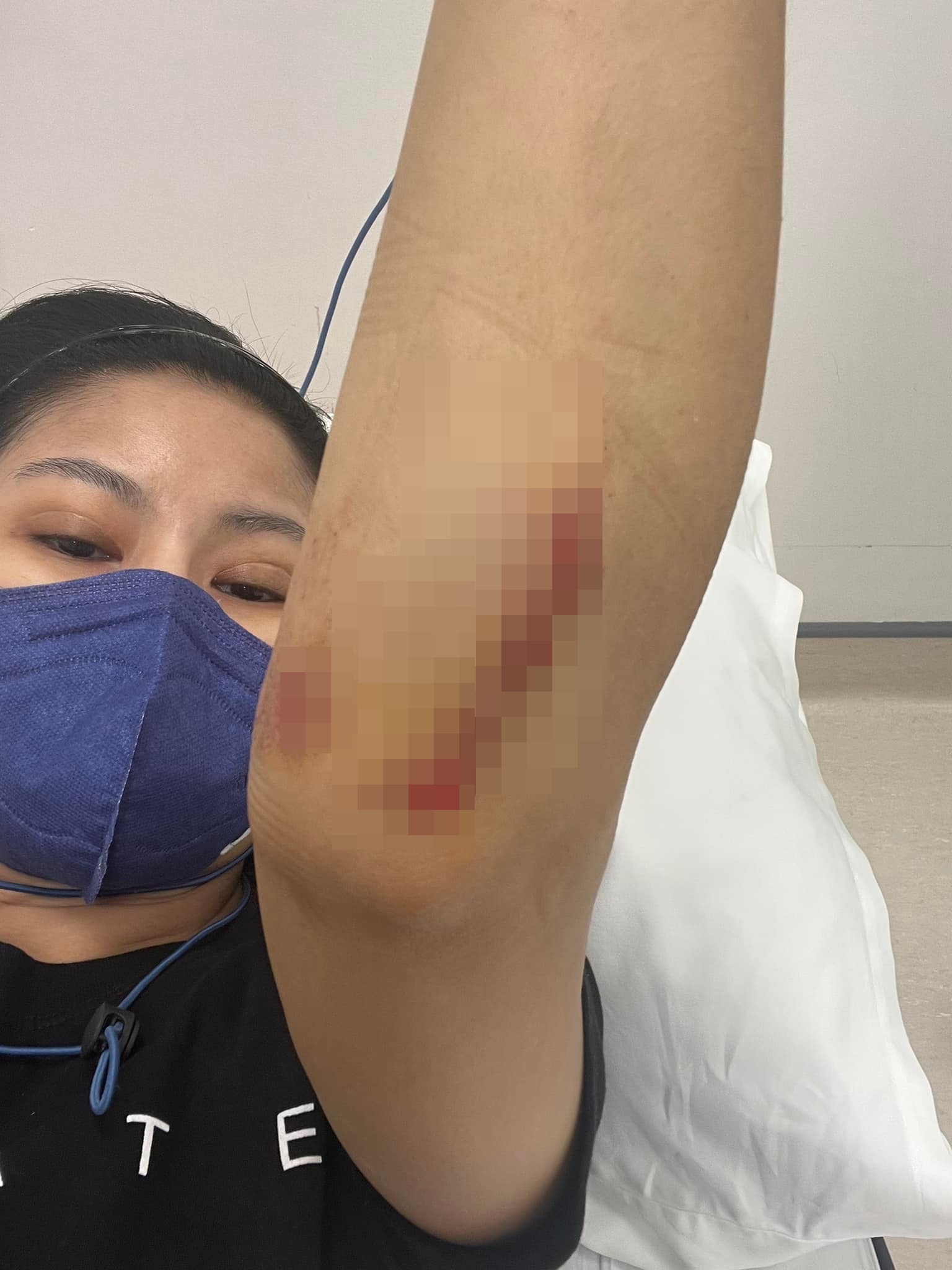 อดีตนักร้องดัง โรสแมรี่ ถูกรถชนแล้วหนี พร้อมเผยอาการบาดเจ็บ