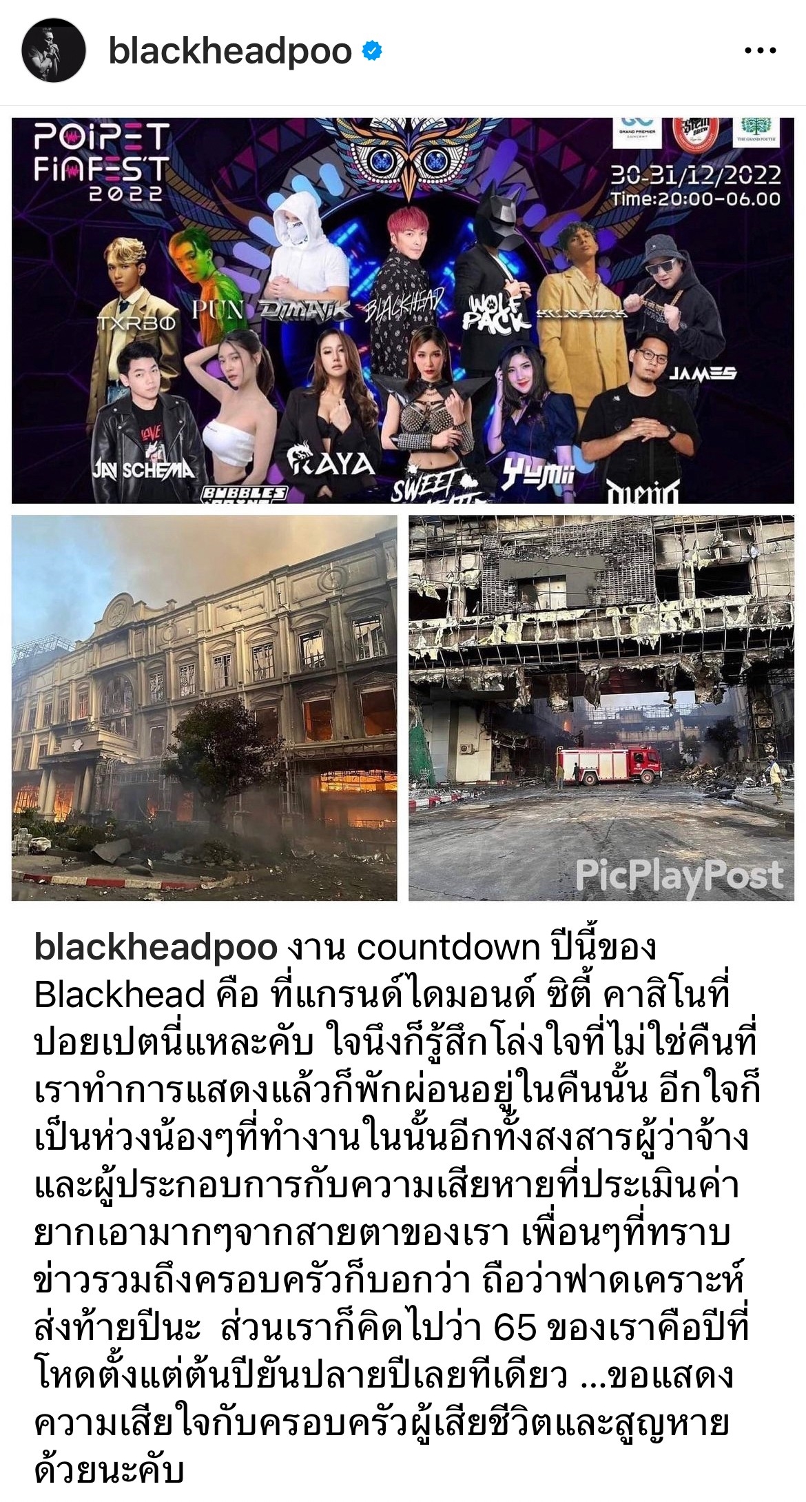 เปิดใจ ปู แบล็คเฮด หลังรู้ข่าวไฟไหม้ที่แกรนด์ไดมอนด์ซิตี้ พร้อมอัปเดตชีวิตในปีหน้า เปิดใจ ปู แบล็คเฮด หลังรู้ข่าวไฟไหม้ที่แกรนด์ไดมอนด์ซิตี้ พร้อมอัปเดตชีวิตในปีหน้า