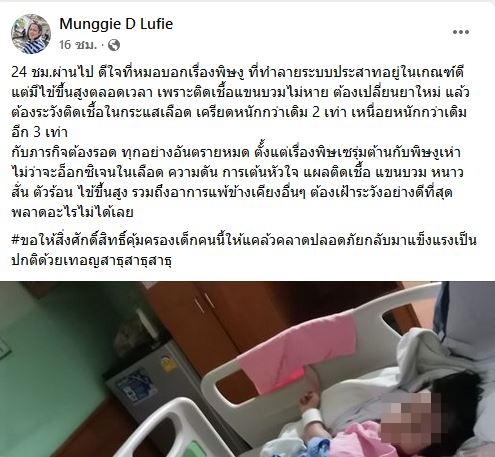 อุทาหรณ์! หนูน้อยถูก งูเห่า กัดอาการโคม่า ผ่านไป 26 ชม.นิ้วเริ่มกระดิกได้