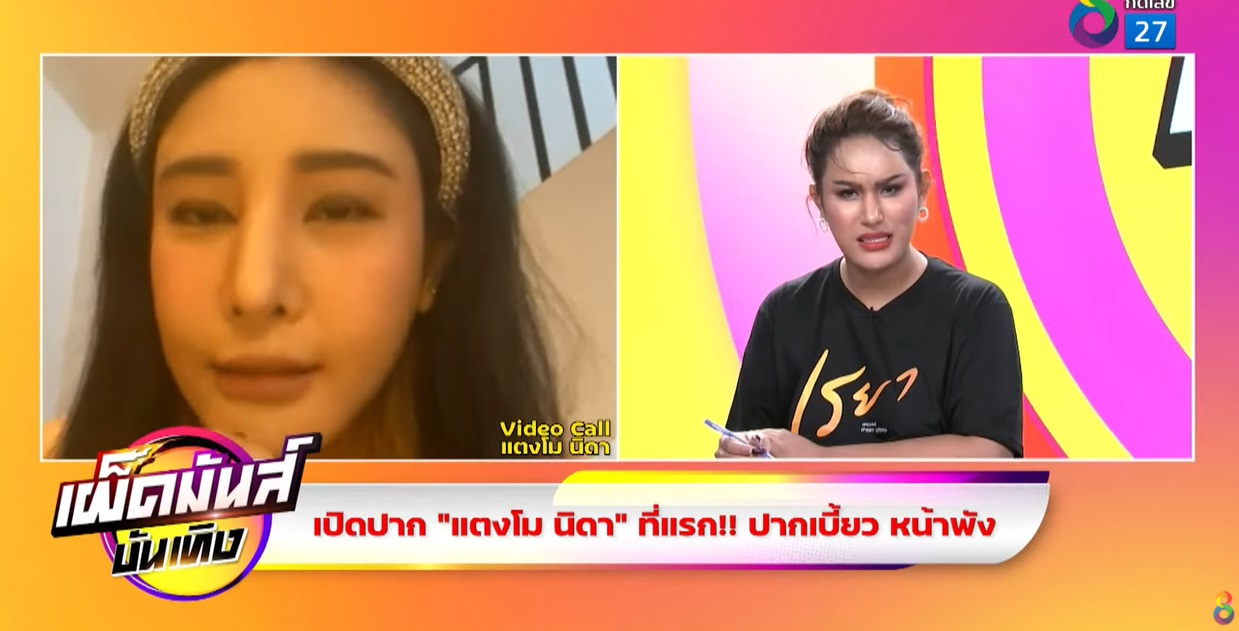 แตงโม นิดา เปิดใจครั้งแรก ปมศัลยกรรมทำพิษ แตงโม นิดา เปิดใจครั้งแรก ปมศัลยกรรมทำพิษ