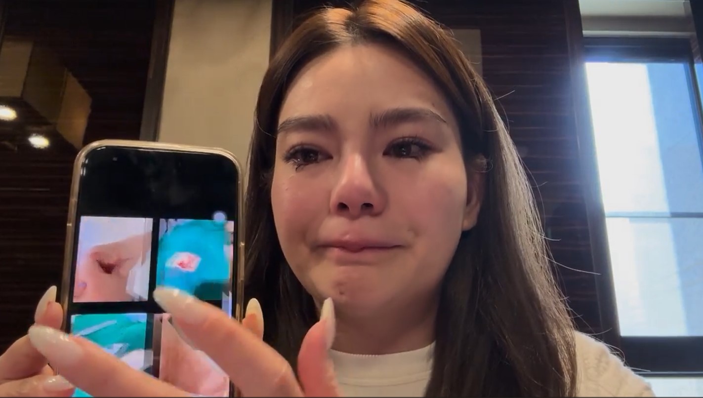 ไผ่ วันพ้อยท์ โพสต์ปกป้อง ดิว อริสรา พร้อมเผยภาพถูกทำร้ายร่างกาย