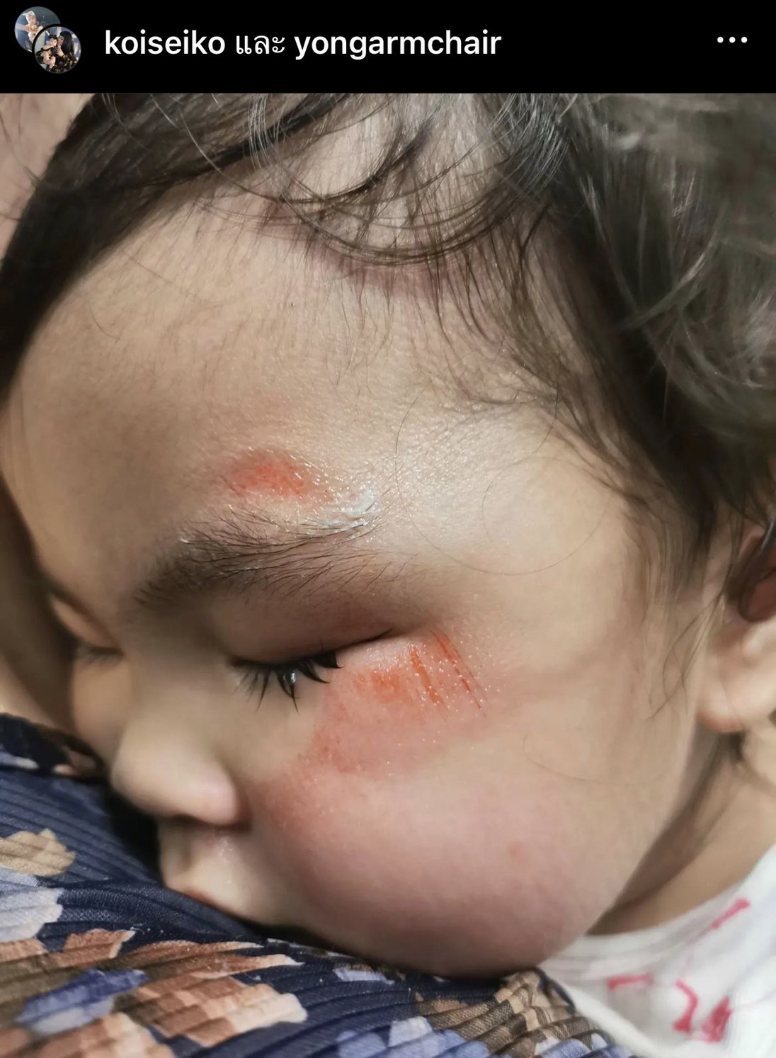 ก้อย-โย่ง สงสารลูกจับใจ น้องอบเชย ล้มหน้าไถล!! ก้อย-โย่ง สงสารลูกจับใจ น้องอบเชย ล้มหน้าไถล!!