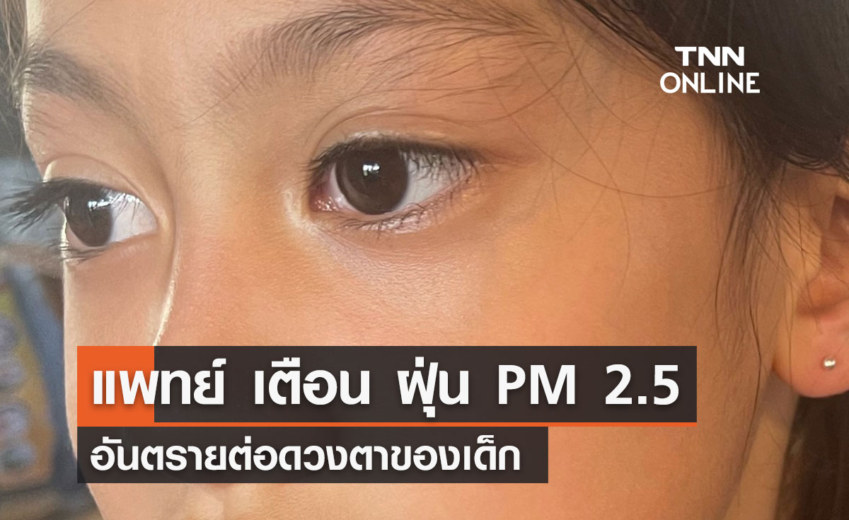 แพทย์ เตือน ฝุ่น PM 2.5 อันตรายต่อดวงตาของเด็ก