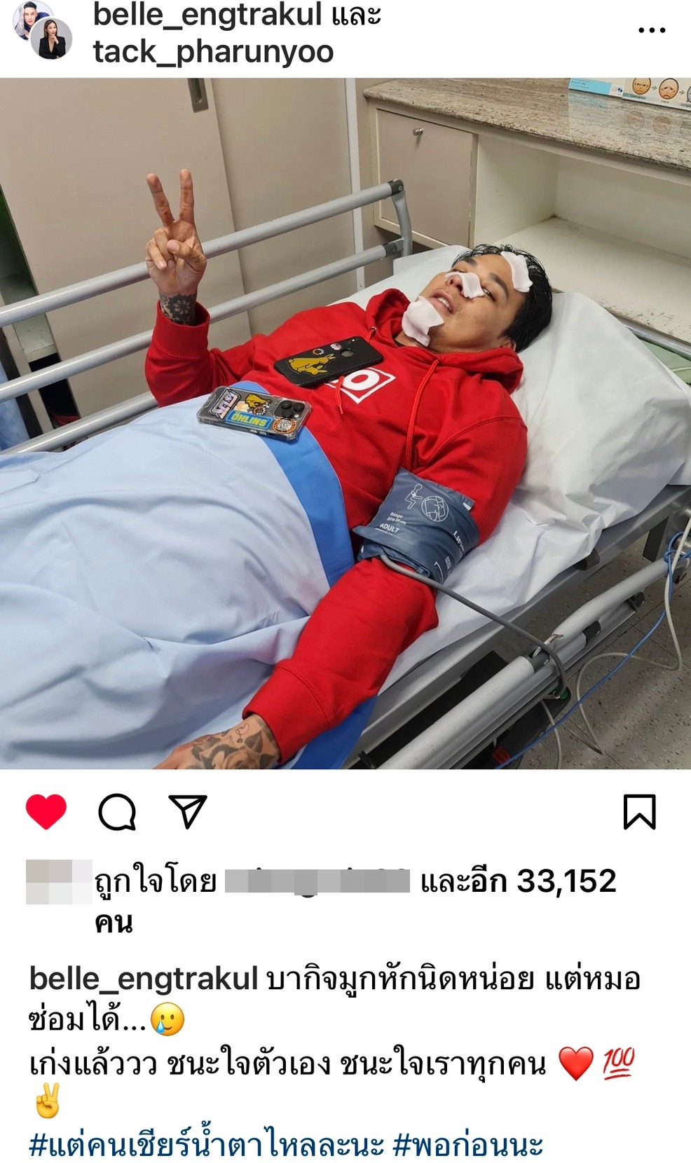 “แทค ภรัณยู” จมูกหัก! หลังถูก “เนท My Mate Nate” สวนหมัดเข้าเต็มหน้า “แทค ภรัณยู” จมูกหัก! หลังถูก “เนท My Mate Nate” สวนหมัดเข้าเต็มหน้า