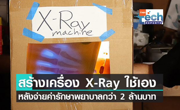 วิศวกรอเมริกัน สร้างเครื่อง X-Ray ใช้เอง หลังเสียค่ารักษาพยาบาลกว่า 2.3 ล้านบาท