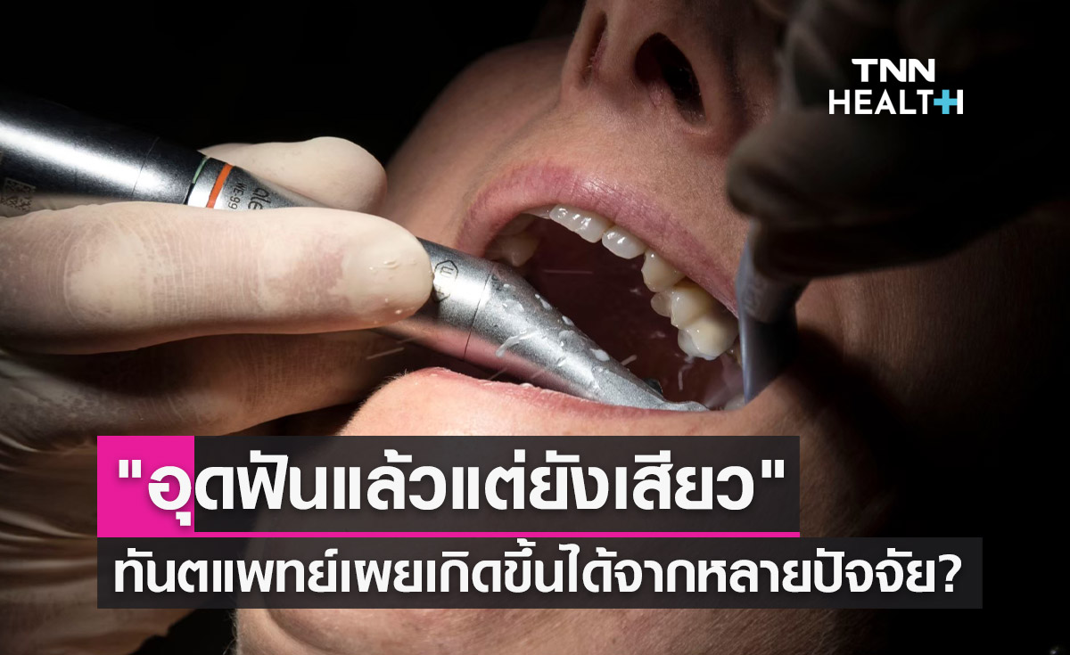 อุดฟันแล้วแต่ยังเสียว ทันตแพทย์เผยเกิดขึ้นได้จากหลายปัจจัย?