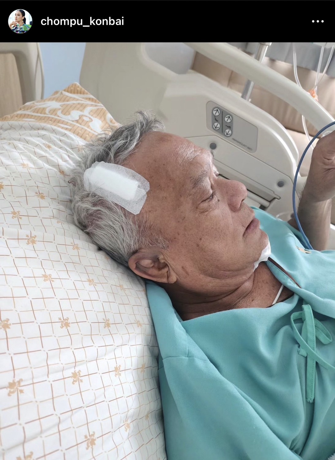 ชมพู่ ก่อนบ่าย ใจหาย หลังพ่อล้มในห้องน้ำ ต้องเฝ้าติดตามอาการใน ICU ชมพู่ ก่อนบ่าย ใจหาย หลังพ่อล้มในห้องน้ำ ต้องเฝ้าติดตามอาการใน ICU