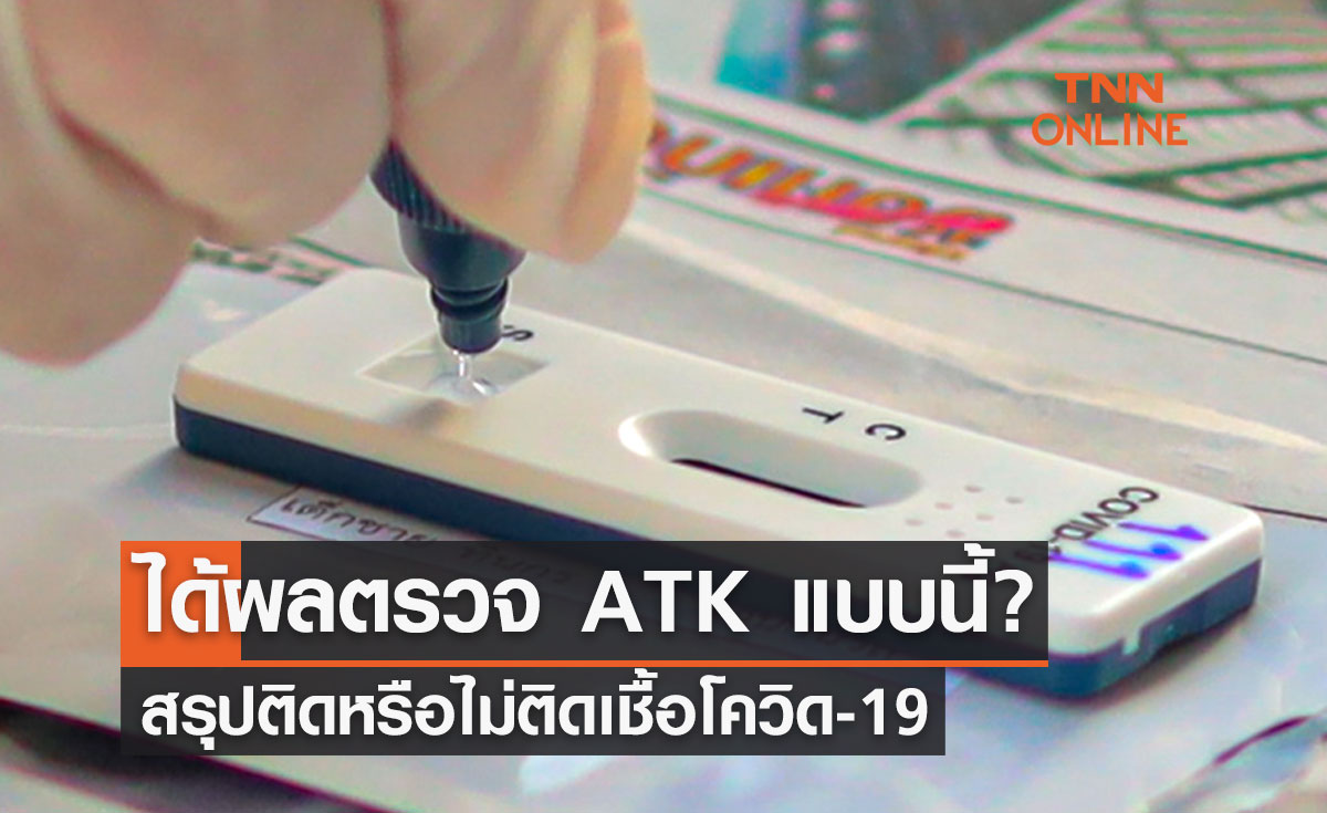 แนวทางตรวจเชื้อโควิดด้วยตนเอง ได้ผล ATK แบบนี้? สรุปติดหรือไม่ติดเชื้อ