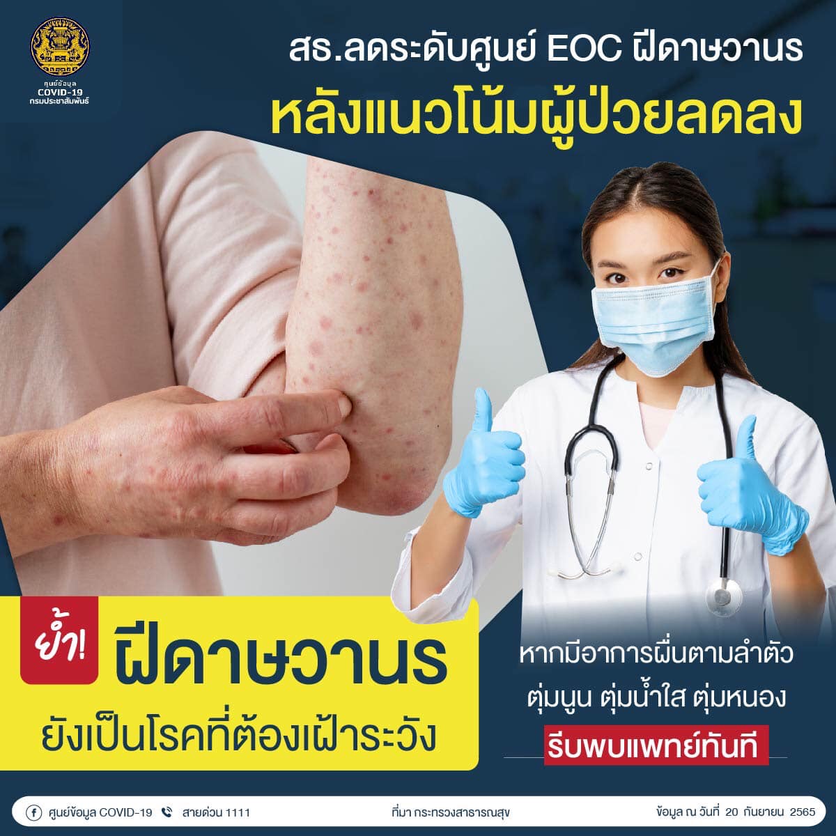 สธ.ลดระดับศูนย์ EOC ฝีดาษลิง หลังแนวโน้มผู้ป่วยลดลง-ยังเฝ้าระวัง สธ.ลดระดับศูนย์ EOC ฝีดาษลิง หลังแนวโน้มผู้ป่วยลดลง-ยังเฝ้าระวัง