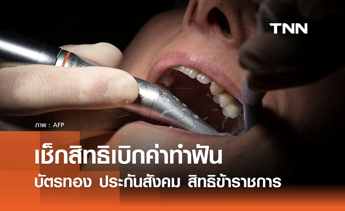เปิดสิทธิประโยชน์ "เบิกค่าทำฟัน" บัตรทอง ประกันสังคม ข้าราชการ
