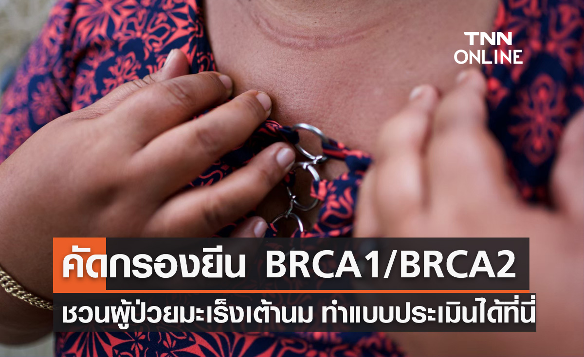 ชวนผู้ป่วยมะเร็งเต้านม ทำแบบประเมิน รับสิทธิตรวจคัดกรองยีน BRCA1/BRCA2