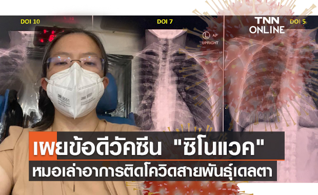 หมอ เล่าอาการติดเชื้อโควิดสายพันธุ์เดลตา พร้อมเผยข้อดีซิโนแวค