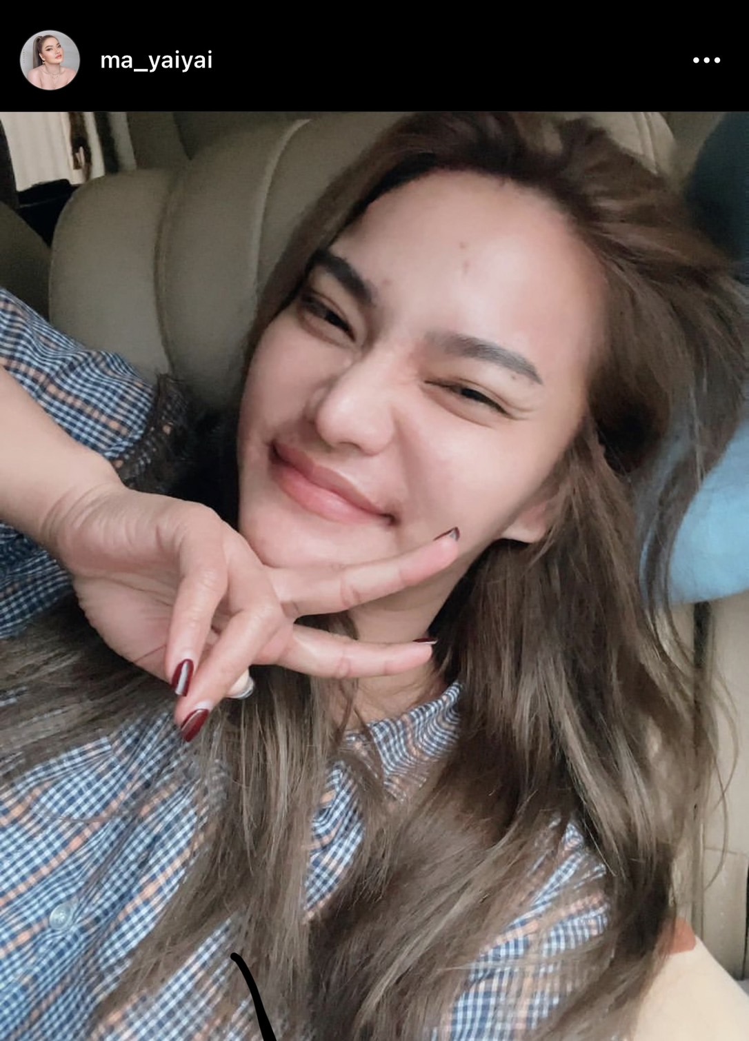 ใหม่ พัชรี ช็อก!!รถตู้เสียหลักพุ่งข้างเข้าถนน