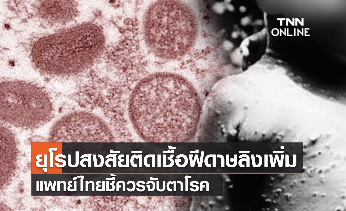 (คลิป) ยุโรปสงสัยติดเชื้อฝีดาษลิงเพิ่มเป็น 6 ประเทศ - แพทย์ไทยชี้ควรจับตาโรค