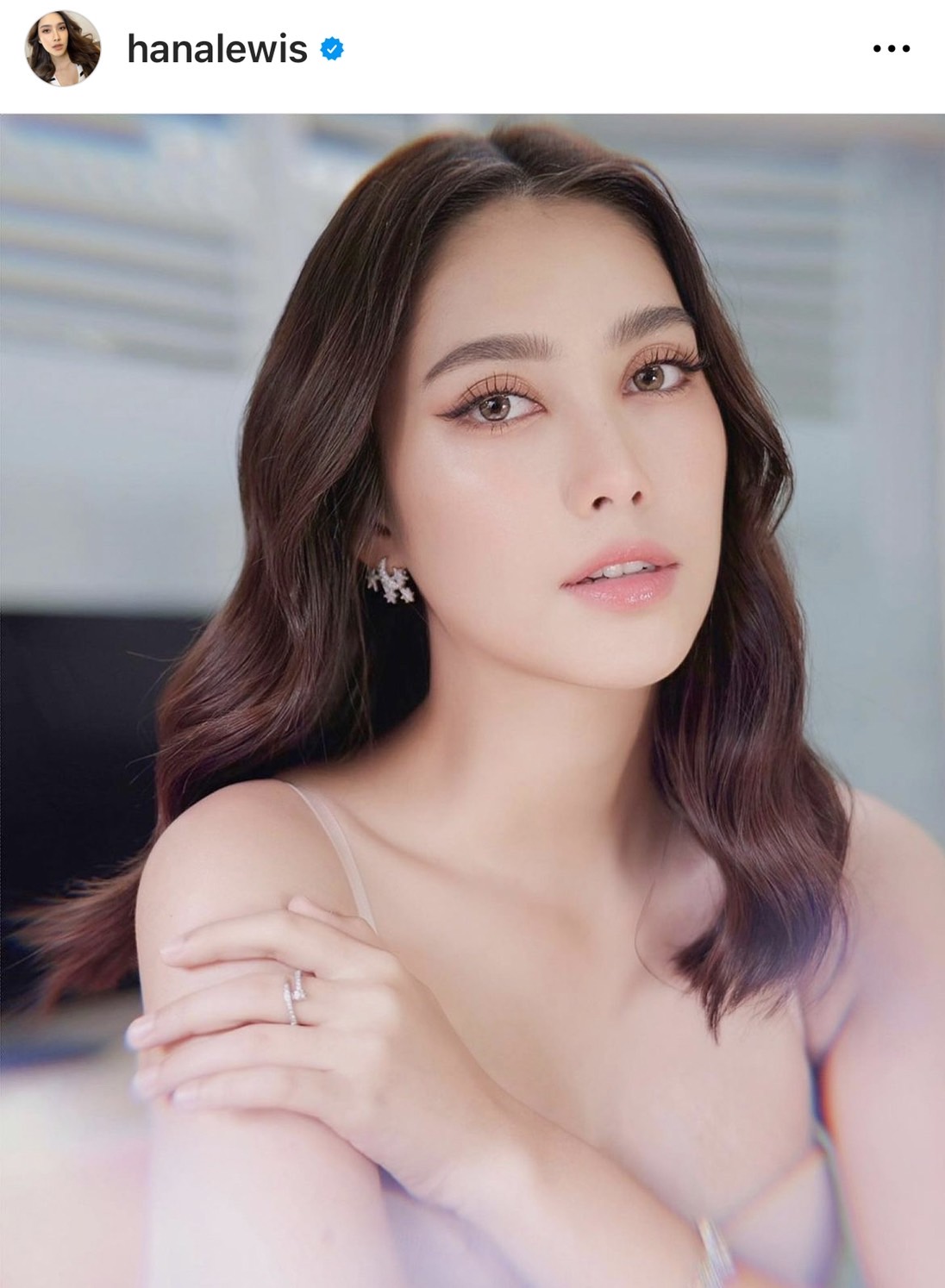 ฮาน่า ลีวิส ทำแฟนคลับเป็นห่วง หลังมีอาการกระจกตาถลอก เยื้อตาอักเสบ