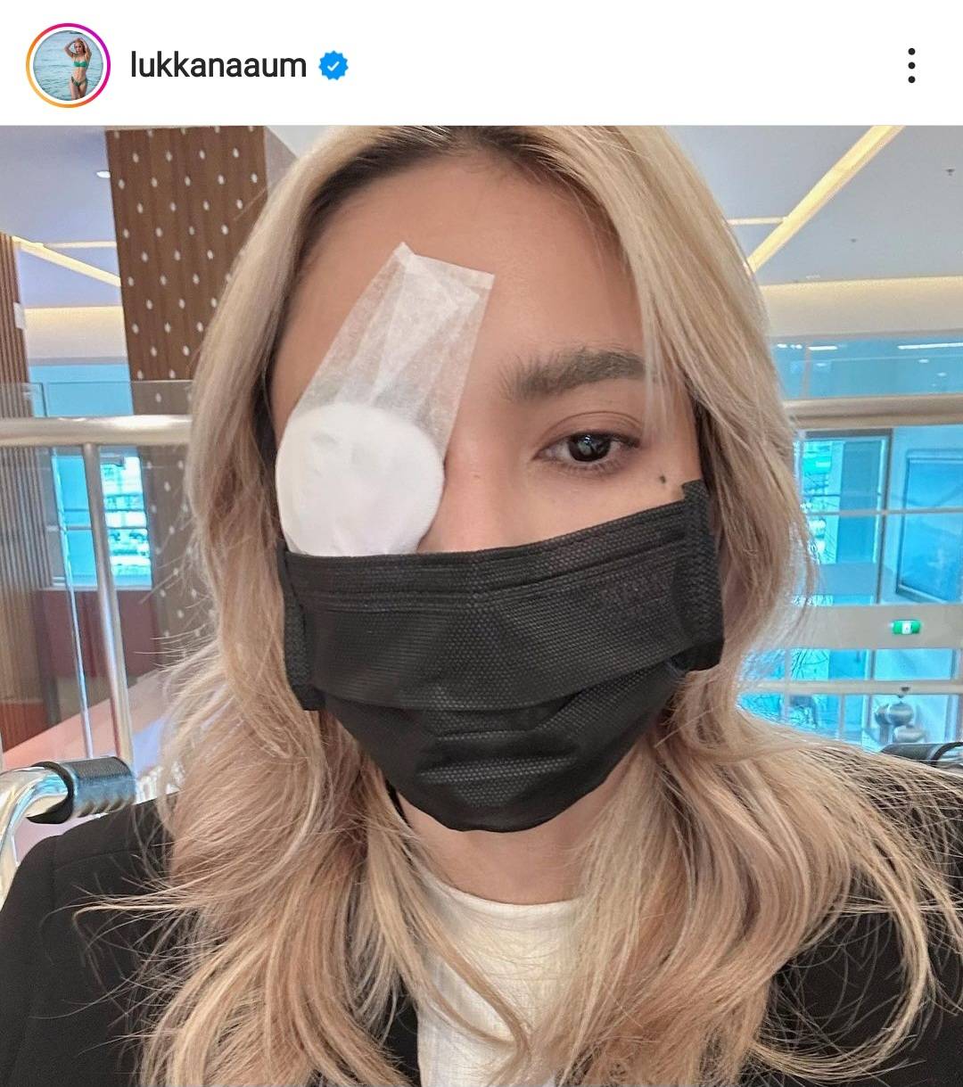 อุ้ม ลักขณา เกิดอุบัติเหตุขณะเล่นกับลูก แผลถลอกในตาดำ อุ้ม ลักขณา เกิดอุบัติเหตุขณะเล่นกับลูก แผลถลอกในตาดำ